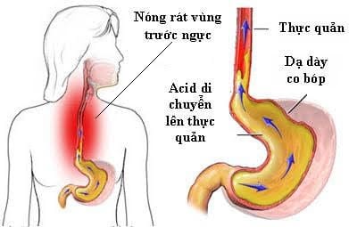 a_xit_trao_nguoc_ILKC