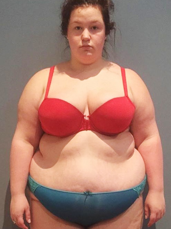Cô gái quyết ăn Chay và giảm được 76 kg khiến ai cũng trầm trồ 1 co gai giam 76 kg sau khi bi bat nat kho sinh con c95 5144047